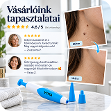 Otthoni Bőrkinövés Eltávolító Készlet