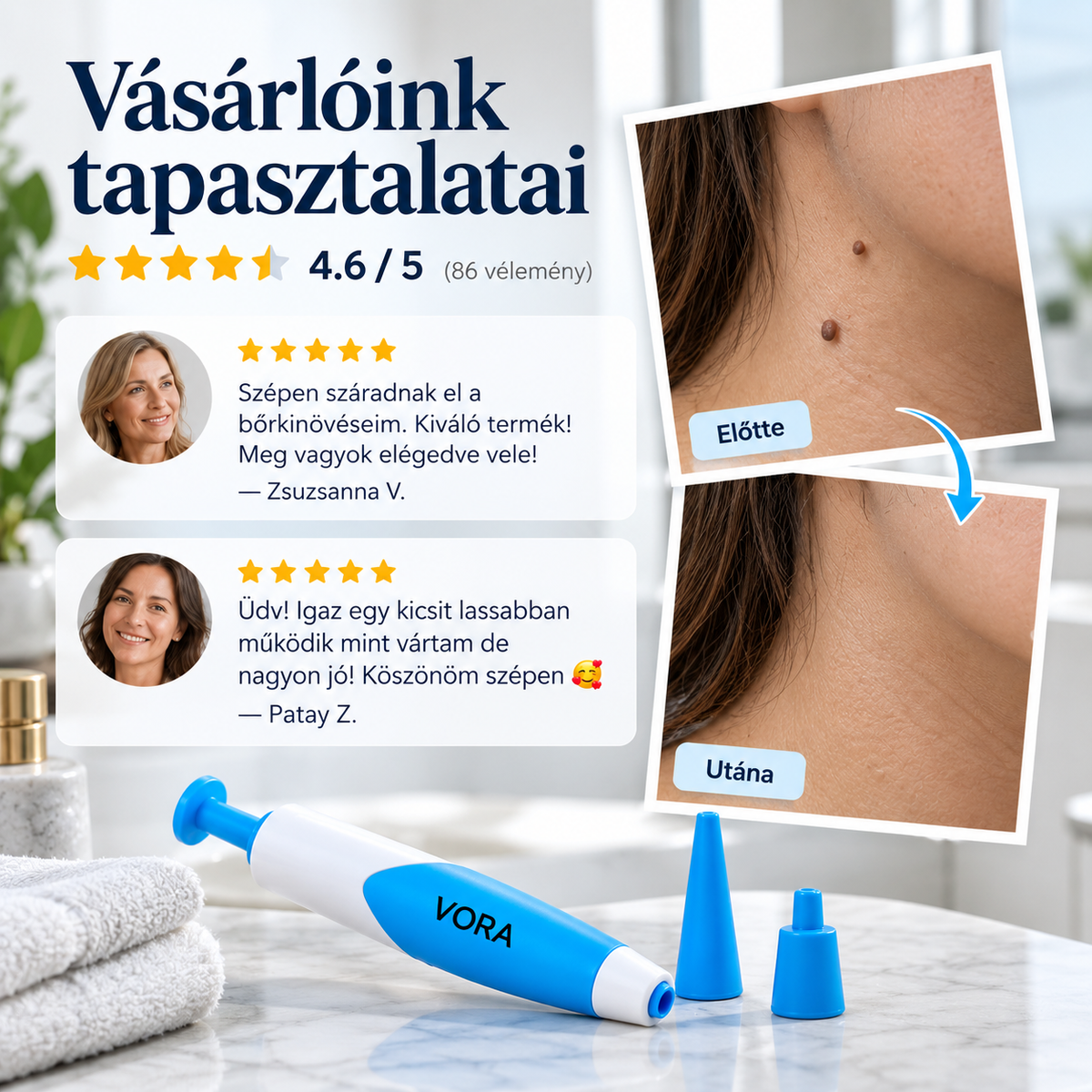 Otthoni Bőrkinövés Eltávolító Készlet