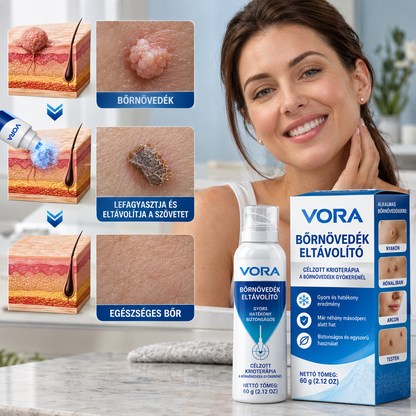 Bőrkinövés elleni fagyasztó spray
