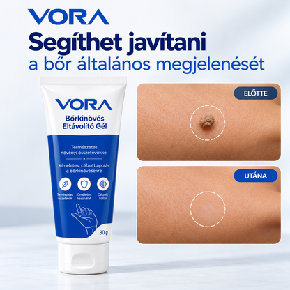 Bőrregeneráló gél
